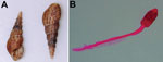 Thumbnail of Snail and trematode cercaria from study of ocular inflammation in children, South India. A) Melanoides tuberculata snails collected from a pond that was the focus of the infection. B) Staining and light microscopy image of the cercaria larval stage recovered from the snails (original magnification × 200).