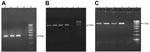 Thumbnail of PCR amplification of trematode cercaria DNA obtained from Melanoides tuberculata snails in study of ocular inflammation in children, South India. Gel electrophoresis was performed on 1.5% agarose gel. A) Internal transcribed spacer 2 region; arrow indicates 369-bp amplified DNA product. Lanes 1–3, trematode cercariae DNA; lane 4, negative control; lane 5, 100-bp DNA marker. B) Internal transcribed spacer 2 region; arrow indicates 539-bp–amplified DNA product. Lanes 1–4, trematode ce