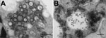 Thumbnail of Electron micrographs of Middelburg virus isolate SAE25/2011 in baby hamster kidney cell culture. A) Several enveloped virions consisting of a dense core and surrounded by a translucent layer are shown in the vesiculated endoplasmic reticulum. The virus has elongated forms and numerous precursor nucleocapsids in the cytoplasm. Many of the nucleocapsids are associated with the outer surfaces of the vesiculated endoplasmic reticulum. Scale bar indicates 500 nm. B) Virions in a cytopath