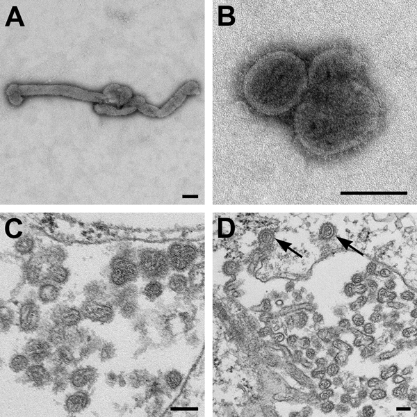Electron microscopic images of novel Thogotovirus isolate. Filamentous (A) and spherical (B) virus particles with distinct surface projection are visible in culture supernatant that was fixed in 2.5% paraformaldehyde. Thin-section specimens (C and D), fixed in 2.5% glutaraldehyde, show numerous extracellular virions with slices through strands of viral nucleocapsids. Arrows indicate virus particles that have been endocytosed. Scale bars indicate 100 nm.