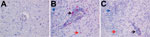 Thumbnail of Detection of fox circovirus–specific transcripts in brain tissue of foxes with neurologic disease showing in situ hybridization of cerebrum with fox circovirus replication initiator protein gene–specific probe (original magnification ×200). A) Negative control fox VS7100012. The serum sample from this fox was negative for circovirus, and the animal did not exhibit signs of neurologic disease. B, C) Affected foxes VS7100005 and VS7100003, respectively. Both animals had neurologic dis