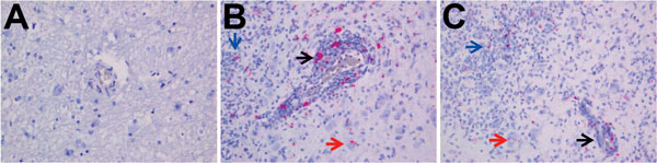 Detection of fox circovirus–specific transcripts in brain tissue of foxes with neurologic disease showing in situ hybridization of cerebrum with fox circovirus replication initiator protein gene–specific probe (original magnification ×200). A) Negative control fox VS7100012. The serum sample from this fox was negative for circovirus, and the animal did not exhibit signs of neurologic disease. B, C) Affected foxes VS7100005 and VS7100003, respectively. Both animals had neurologic disease, and the