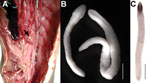 Thumbnail of Photomicrograph of plerocercoids of Adenocephalus pacificus from Sarda cholensis off Peru. A) Body cavity with encysted plerocercoid (arrow). B) Liberated plerocercoids under stereomicroscope. Scale bar indicates 1 mm. C) Whole mount of the plerocercoid. Scale bar indicates 2 mm.