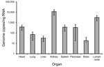 Thumbnail of Quantification of hantavirus RNA in tissue biopsies from a 50-year-old Sochi virus–infected man (patient no. 59), Russia. Two independent approaches were performed to extract RNA from each organ. Quantitative reverse transcription PCR previously developed for DOBV (7) was used to measure virus load in the analyzed biopsy samples. Three quantitative reverse transcription PCR estimations were conducted for every RNA extraction, followed by calculation of mean values and SDs. Viral RNA