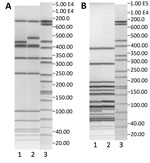 Thumbnail of Pulsed-field gel electrophoresis (PFGE) profiles with AscI (A) and ApaI (B) restriction enzymes of the 2 most common pulsotypes, 40–42 and 38–48, in Denmark, 2002–2012. A) Lane 1, pulsotype 38–48, GX6A16.0038 DK; lane 2, pulsotype 40–42, GX6A16.0040; lane 3, markers. B) Lane 1, pulsotype 38–48, GX6A12.0048 DK; lane 2, pulsotype 40–42, GX6A12.0042 DK; lane 3, markers. Both pulsotypes belong to clonal complex 8.