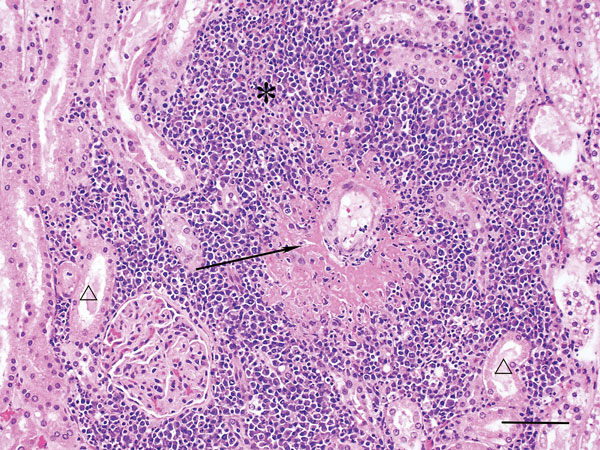 Kidney of dog infected with Hendra virus, showing marked vasculitis (arrow) and inflammatory infiltrates (*) effacing renal tubules (△). Scale bar indicates 75 μm.