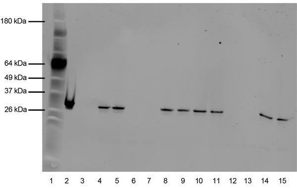 Western blot of pertussis toxin (Pt) expression in Bordetella pertussis Tohama I, I979, FR3749, and 3 additional recent isolates. All isolate lanes were loaded with 10-μg of protein, extracted after 48 hours’ growth. Protein was transferred with the iBlot Dry Blotting system (Invitrogen, Carlsbad, CA, USA). The primary antibody consisted of 1b7 anti-PTX S1 monoclonal antibody at a concentration of 20 μg/mL diluted in 0.01 M PBS/Tween with 5% milk. The secondary antibody was a FITC-conjugated goa