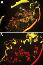 Transmission of Severe Fever with Thrombocytopenia Syndrome Virus by Haemaphysalis longicornis Ticks, China 