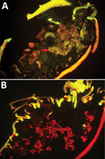 Thumbnail of Specific detection of severe fever with thrombocytopenia syndrome virus (SFTSV) in microinjected Haemaphysalis longicornis ticks by indirect fluorescence assay. A) SFTSV-injected ticks 12 days after microinjection (original magnification ×10). Red arrows indicate specific fluorescence s. B) Phosphate-buffered saline–injected ticks 12 days after microinjection (original magnification ×10). No specific fluorescene is seen.