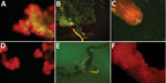 Thumbnail of Specific detection of severe fever with thrombocytopenia syndrome virus (SFTSV) in tissues of adult Haemaphysalis longicornis ticks by indirect fluorescence assay. The green fluorescence represents the SFTS virus.  A) Salivary gland of SFTSV-injected tick (original magnification ×40). B) Midgut of SFTSV-injected H. longicornis tick (original magnification ×10). C) Ovary of SFTSV-injected tick (original magnification ×40). D) Salivary gland of phosphate-buffered saline (PBS)–injected