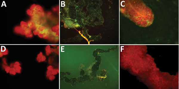 Specific detection of severe fever with thrombocytopenia syndrome virus (SFTSV) in tissues of adult Haemaphysalis longicornis ticks by indirect fluorescence assay. The green fluorescence represents the SFTS virus.  A) Salivary gland of SFTSV-injected tick (original magnification ×40). B) Midgut of SFTSV-injected H. longicornis tick (original magnification ×10). C) Ovary of SFTSV-injected tick (original magnification ×40). D) Salivary gland of phosphate-buffered saline (PBS)–injected tick (origin