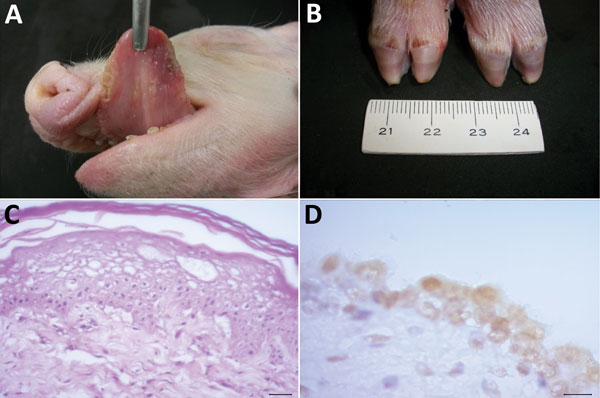 Pathologic alterations in piglets infected with Senecavirus A, Brazil, 2015. Gross examination shows multifocal diphtheric glossitis (A) and ulcerations of the coronary band (B). Histopathologic images demonstrate ballooning degeneration of the epithelium of the tongue (C) and positive immunoreactivity of the uroepithelium of the urinary bladder (D) to Senecavirus A. Panel B, scale shown in centimeters; panel C, hematoxylin and eosin stain, scale bar indicates 20 μm; panel D, immunoperoxidase, s