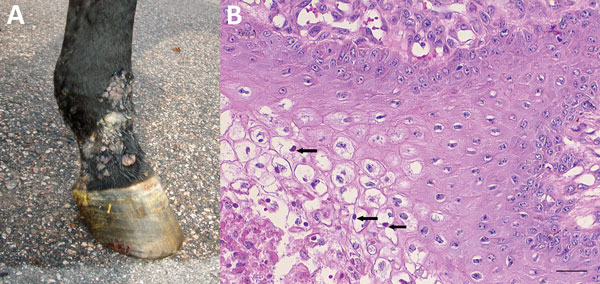 Macroscopic and histologic images of horse infected with possible novel parapoxvirus, Finland, 2013. A) Proliferative and ulcerative skin lesions were seen multifocally on the muzzle, ventral abdomen, and lower limbs (pictured). B) The main histological changes in samples of the skin lesions were severe multifocal lymphohistiocytic dermatitis with marked ballooning degeneration of the stratum granulosum and eosinophilic intrasytoplasmic inclusion bodies in many keratinocytes (arrows). Scale bar 