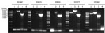 Thumbnail of Long PCR analysis of the VT2f phage of verotoxigenic Escherichia coli (VTEC) strains isolated from fecal samples from humans with hemolytic uremic syndrome (EF467, EF476, EF453) and from pigeon feces (ED363, ED377). Numbers at left indicate bps; lane numbers indicate PCR 1 to PCR 4. The expected size of the amplicons were 6,331 bp (PCR 1), 8,166 bp (PCR 2), 3,927 bp (PCR 3), and 8,808 bp (PCR 4).