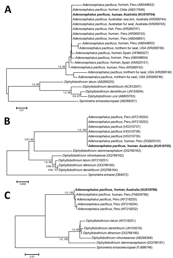 Phylogenetic relationship of genetic sequences from an Adenocephalus pacificus tapeworm obtained from a human in Australia (bold) and selected reference sequences. The relationship was inferred on the basis of DNA sequence analyses of cytochrome c oxidase 1 (A), small subunit RNA (B), and internal transcribed spacer (C) regions, using Bayesian inference and neighbor-joining phylogenetic methods. Topologies of trees generated by both methods were similar; thus, only neighbor-joining trees are sho