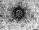 Thumbnail of Electron micrograph of a new chimeric swine enteric coronavirus (SeCoV/GER/L00930/2012), Germany, 2012. Scale bar indicates 100 nm.