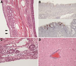 Thumbnail of Signs of mild upper respiratory inflammation, encephalitis, and virus antigen detection in respiratory epithelium of alpacas experimentally infected with Middle East respiratory syndrome coronavirus. A) Turbinate from alpaca A8 showing normal respiratory epithelium on the right with goblet cells (blue cells). Epithelium on the left has undergone squamous metaplasia (arrows) and is focally eroded with mild subepithelial inflammation (original magnification ×100). B) Virus antigen in 