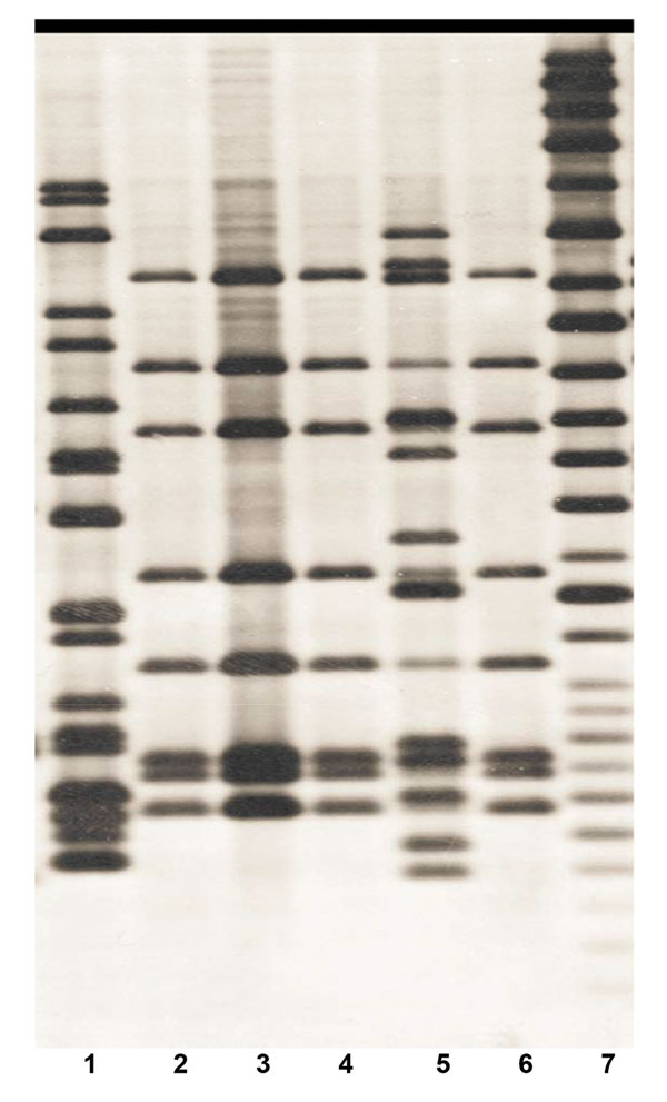 IS6110 Southern blot hybridization patterns of 6 Mycobacterium tuberculosis isolates recovered from elephants A (lanes 1–5) and C (lane 6) (4) in study of tuberculosis in captive elephants, Albuquerque, New Mexico, USA, 1997–2013. The fingerprint pattern in lane 1 types the strain to principal genetic group 1, the fingerprint pattern in lanes 2–4 and lane 6 types the strain to principal genetic group 2 and the fingerprint pattern in lane 5 types the strain to principal genetic group 3. Lane 7, m