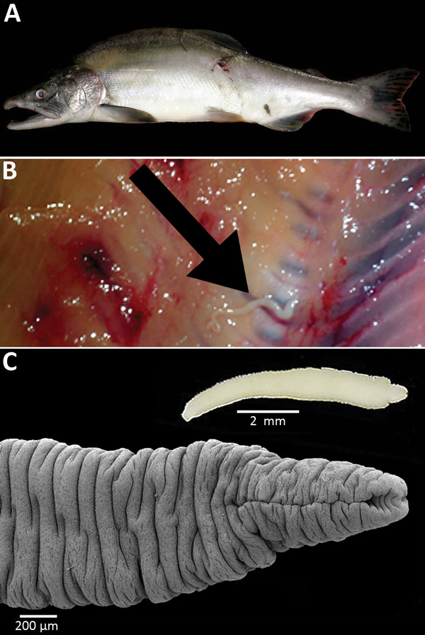 A) Pink salmon (Oncorhynchus gorbuscha) from Alaska, USA. B) Plerocercoid of Japanese broad tapeworm (Diphyllobothrium nihonkaiense) (arrow) deep in the muscles of the salmon. C) Live D. nihonka plerocercoid in saline (inset) and scanning electron micrograph after fixation with hot water; note the scolex with a long, slit-like bothrium opened anteriorly.