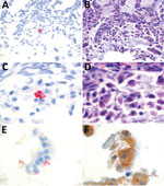 Thumbnail of Detection of harbor porpoise norovirus transcripts in intestinal tissue of a harbor porpoise (Phocoena phocoena) using in situ hybridization with probes designed by Advanced Cell Diagnostics (Hayward, CA, USA), based on the 6,293 nt of harbor porpoise norovirus (A, C, E; original magnification ×40, ×100, ×100, respectively). Consecutive slides were stained with hematoxylin and eosin (B, D; original magnification ×40, ×100, respectively) and pankeratin (F, original magnification ×100