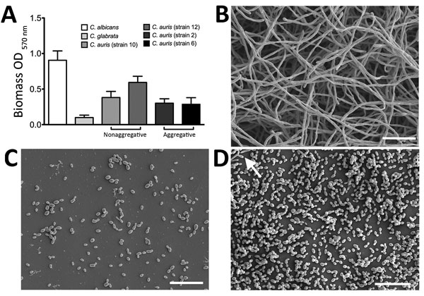 Biofilm formation on Candida auris, C. albicans, and C. glabrata yeast strains. A) Biomass quantities were determined spectrophotometrically for 4 strains of C. auris and 1 each of C. albicans and C. glabrata. Isolates were standardized to 106 cells/mL in RPMI-1640 and grown in flat-bottomed 96-well microtiter plates for 24 h at 37°C. Biofilms were then washed, stained with crystal violet solution, and quantified. Data represent the mean ± SD of experiments performed on 3 separate occasions, usi