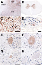 Thumbnail of Immunohistochemical detection of disease-associated prion protein (PrPSc) in a cow at 88 months after oral inoculation with brain homogenate of L-type bovine spongiform encephalopathy agent. A) Low amount of PrPSc deposition in the dorsal motor nucleus of the vagus nerve (DMNV) compared with the more pronounced depositions in the solitary tract nucleus (NST), the spinal tract of trigeminal nerve (STN), and the reticular formation (RFM) in the medulla oblongata at the obex level. Sca