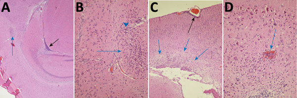 Photomicrographs of Fitzroy River virus (FRV)–induced meningoencephalitis in weanling mice inoculated with 1,000 infectious units of FRV. Panels show multifocal mild to severe perivascular and neuropil infiltration of lymphocytes and monocytes (blue arrows in A–C); meningitis in a sulcus (black arrow in A); glial cell activation with notable astrocytosis, neuron degeneration, and neuronophagia (arrowhead in B); occasional hemorrhage (blue arrow in D); mild periventricular spongiosis (blues arrow