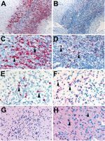 Thumbnail of Localization of Zika virus RNA by in situ hybridization in brain tissues from infants with microcephaly. A) ISH with use of antisense probe. Zika virus genomic RNA (red stain) in cerebral cortex of an infant (case-patient no. 66, gestational age 26 wk). Original magnification ×10. B) ISH with use of sense probe. Serial section showing negative-strand replicative RNA intermediates (red stain) in the same areas shown in panel A. Original magnification ×10. C) ISH with use of antisense