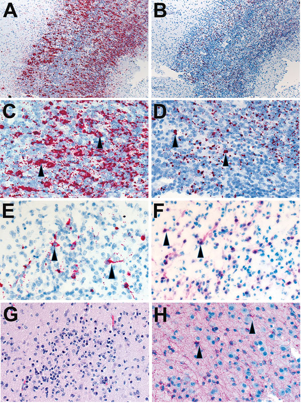 Localization of Zika virus RNA by in situ hybridization in brain tissues from infants with microcephaly. A) ISH with use of antisense probe. Zika virus genomic RNA (red stain) in cerebral cortex of an infant (case-patient no. 66, gestational age 26 wk). Original magnification ×10. B) ISH with use of sense probe. Serial section showing negative-strand replicative RNA intermediates (red stain) in the same areas shown in panel A. Original magnification ×10. C) ISH with use of antisense probe. Highe