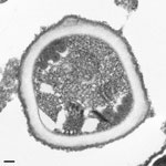 Thumbnail of Transmission electron microscopy of microsporidia identified in allograft samples from right kidney recipient. The organism shows cross-sections through the polar tube with up to 6 coils and a unikaryotic nucleus, which is characteristic of Encephalitozoon cuniculi. Scale bar indicates 100 nm. 