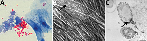 Microsporidia identified in urine samples from liver recipient. A) Urine trichrome stain. Original magnification ×100. B) Cell culture showing microsporidium (arrow). Original magnification ×200. C) Transmission electron microscopic image of infected cell culture with germinating microsporidial spore (arrow). Scale bar indicates 500 nm. 