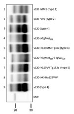 Thumbnail of Biochemical comparison of brain protease-resistant prion protein (PrPres) detected in transgenic mice expressing prion protein Met129, and Val129 mice and inoculated with vCJD brain homogenate. Similar quantities of PrPres were loaded for adequate comparison, and immunoblots were detected by using Sha31 monoclonal antibody. Lanes 4 and 6 show passages from this study; lane 5 shows sample codification I-10629, and lane 7, sample codification I-11724 from the MRC Prion Unit in the Uni
