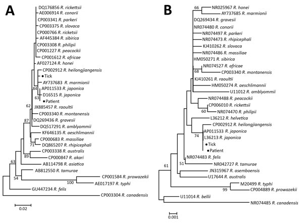 Phylogenetic analysis of Rickettsia isolate from patient with Japanese spotted fever in Anhui Province and isolate from Haemaphysalis longicornis tick in Shandong Province, China, 2013 (black dots), compared with reference isolates. Unrooted neighbor-joining trees of 16S rRNA gene (A) and 17-kDa protein gene (B) were constructed by using MEGA 5.2 (https://www.megasoftware.net/) and 1,000 bootstrap replications. Scale bar represents substitutions per nucleotide.