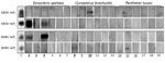 Thumbnail of Western blot results of individual bat serum samples probed against Zaire ebolavirus and Bundibugyo ebolavirus glycoproteins 1 and 2 (GP1, GP2). Boldface indicates positivity by Western blot and underlining indicates positivity by Bio-Plex (Bio-Rad, Hercules, CA, USA). 1, soluble GP1 and GP2 blotted with control anti–Ebola virus nonhuman primate polyclonal serum that demonstrates cross-reactivity with Bundibugyo ebolavirus soluble GP. Other numbers along baseline correspond to the f