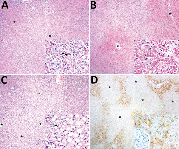 Histopathologic and immunohistochemical findings in the livers of neotropical nonhuman primates that died of yellow fever, Espirito Santo, Brazil, January 2017. Asterisks (*) indicate centrilobular veins. A) Midzonal and centrilobular bridging hepatocellular lytic necrosis. Original magnification ×40; hematoxylin and eosin (H&amp;E) staining. Inset shows lytic hepatocellular necrosis with multiple Councilman-Rocha Lima (apoptotic) bodies (arrows). Original magnification ×400; H&amp;E staining. B