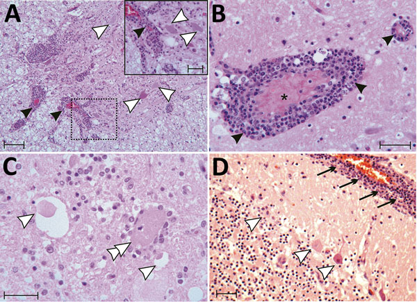 Tissue sections of cervical spinal cord (A), brainstem (B, C) and cerebellum (D) stained with hematoxylin and eosin from a symptomatic newly weaned pig from a farm in Hungary show the signs of stage 3 encephalomyelitis. Mononuclear perivascular cuffs with vasculitis (black arrowheads), neuronal necrosis (white arrowheads), neurophagia (white double arrowheads), multifocal microgliosis, and signs of meningitis (black arrows) are shown. Scale bars indicate 50 µm (panels A, D) or 20 µm (panel A ins