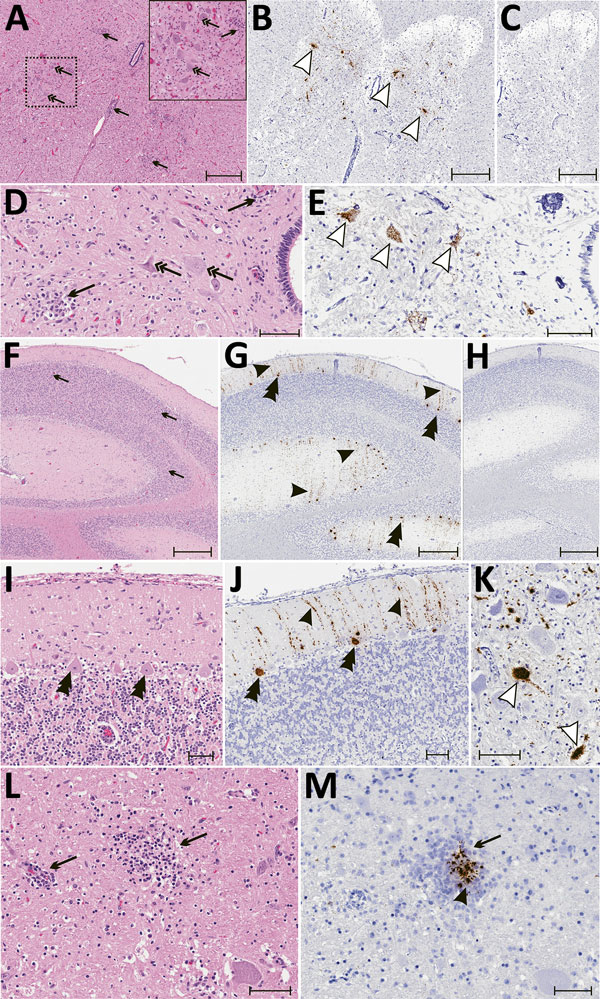 Results of histopathologic testing of central nervous system tissues from 2 symptomatic newly weaned pigs from a farm in Hungary. Sections of the cervical spinal cord (A–E), cerebellum (F–J), and cortex (L, M) from the index animal (GD-1) and the brainstem (K) from an additional affected stage 1 animal (GD-11). A, D, F, I, L) Hematoxylin and eosin stain. Gliosis (black arrows) is multifocal within the gray matter (panels A, D) and in the molecular layers (panels F, I, L and M). Neuronal degenera