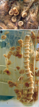 Thumbnail of Armillifer armillatus parasites in man with pentastomiasis. A) Typically coiled Armillifer armillatus nymphs, averaging 1–2 cm long and consistently showing &lt;22 annuli. B) Adult female and numerous nymphs; reference material from the Educational Department, Institute of Tropical Medicine, Antwerp, Belgium. 