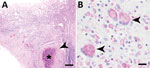 Thumbnail of Results of histologic testing of samples from a domestic rabbit with Mycobacterium avium subsp. hominissuis infection, Germany A) Hematoxylin and eosin stain reveals multifocal severe granulomatous enteritis in the ileum with focally extensive necrosis (asterisk) and numerous surrounding macrophages (arrowhead). Scale bar indicates 300 µm. B) Ziehl-Neelsen stain shows numerous acid-fast bacilli in the cytoplasm of macrophages and multinucleated giant cells (arrowheads). Scale bar in