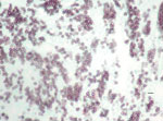 Thumbnail of Methenamine silver stain of mediastinal lymph node biopsy, demonstrating small round or oval yeasts in tissue, from a patient infected with novel fungal species Emergomyces canadensis (case-patient 2), Saskatoon, Saskatchewan, Canada, 2003. Scale bar indicates 10 µm.