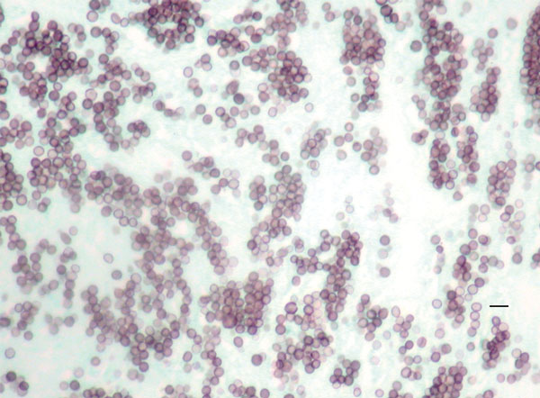 Methenamine silver stain of mediastinal lymph node biopsy, demonstrating small round or oval yeasts in tissue, from a patient infected with novel fungal species Emergomyces canadensis (case-patient 2), Saskatoon, Saskatchewan, Canada, 2003. Scale bar indicates 10 µm.