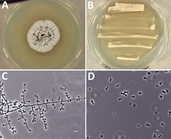 Morphologic features of novel fungal species Emergomyces canadensis isolated from case-patient 2, Saskatoon, Saskatchewan, Canada, 2003. A–B) Colonies grown on potato dextrose agar showing mold phase after 28 days at 30°C (A) and yeast phase after 9 days at 35°C (B). C) Mycelial phase showing 1–3 conidia borne at the ends of slightly swollen conidiophores or sessile on hyphae. Scale bar indicates 5 µm. D) Round to oval yeast cells with narrow-based budding produced at 35°C. Scale bar indicates 5