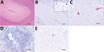 Thumbnail of Histologic analysis and fluorescent in situ hybridization (FISH) of a Batai virus BATV)–infected harbor seal, Germany, 2016. A) Cerebellum showing mild-to-moderate, perivascularly accentuated, lymphohistiocytic inflammation (hematoxylin and eosin stain; scale bar indicates 200 μm). B) Purkinje cells and neurons of granular cell layer showing intracytoplasmic BATV–specific pink, positive result detected by FISH (fast red stain; scale bar indicates 200 µm). Inset: Higher magnification