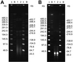 Thumbnail of Pulsed-filed gel electrophoresis profiles of ApaI (A) and SmaI (B) digested genomic DNA of Pasteurella multocida isolates from an 83-year-old man with a urinary tract infection (lane 1) and his pet dog (lane 2). Lanes λ (Lambda Ladder PFGE marker [New England BioLabs; Ipswich, MA, USA]) and lanes B (DNA from Salmonella enterica serovar Branderup H9812 digested with XbaI) used as molecular size standards.