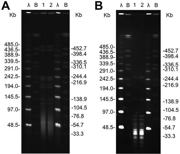 Pulsed-filed gel electrophoresis profiles of ApaI (A) and SmaI (B) digested genomic DNA of Pasteurella multocida isolates from an 83-year-old man with a urinary tract infection (lane 1) and his pet dog (lane 2). Lanes λ (Lambda Ladder PFGE marker [New England BioLabs; Ipswich, MA, USA]) and lanes B (DNA from Salmonella enterica serovar Branderup H9812 digested with XbaI) used as molecular size standards.