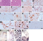 Thumbnail of Hematoxylin and eosin staining (A, B), immunohistochemistry (C–O), and paraffin-embedded tissue blot analysis (P–S) of brains of dromedary camels brought for slaughter to the Ouargla abattoir, Algeria, 2015–2016. Spongiform change of neuropil, gliosis, and neuronal loss in thalamus (A) and intraneuronal vacuolation in pons (B) (scale bar = 50 μm). Immunohistochemistry for prion protein (PrPSc) with L42 monoclonal antibody evidenced dense synaptic/punctate deposition in thalamus (C) 