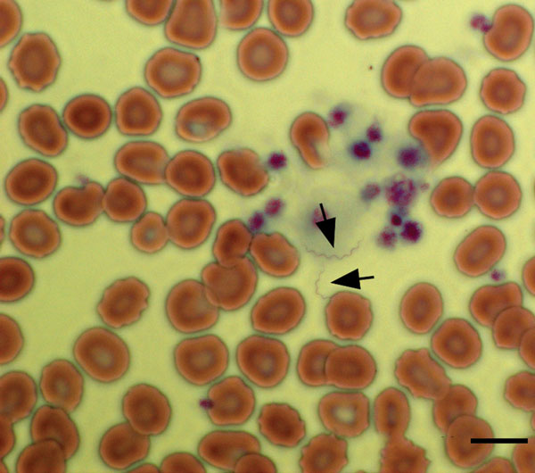 Giemsa-stained peripheral blood smear of a 34-year-old woman with tickborne relapsing fever, Austin, Texas, USA, showing 2 spirochetes (arrows). Scale bar indicates 20 μm.