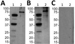 Thumbnail of Serologic responses to Borrelia turicatae protein lysates and rBipA in 34-year-old woman with tickborne relapsing fever, by detected by immunoblotting, Austin, Texas, USA. A) Serum sample from the case-patient; B) positive control serum sample from another case-patient; C) negative control sample. Lane 1, B. turicatae; lane 2, rBipA. Values on the left are in kilobases. Asterisks (*)  indicate the size of native BipA. rBipA, recombinant Borrelia immunogenic protein A.
