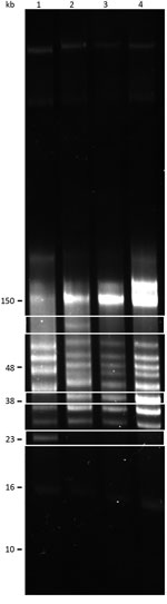 Thumbnail of Reversed-field gel electrophoresis of Borrelia turicatae isolates collected from Ornithodors turicata ticks, Austin, Texas, USA (BRP1, BRP1a, and BRP2) and an isolate from previously field-collected ticks (91E135) (9). Lane 1, 91E135; lane 2, BRP1; lane 3, BRP1a; lane 4, BRP2. White boxes indicate a plasmid in BRP1 that is absent from the other strains (top); plasmids unique to BRP1, BRP1a, and BRP2 (middle); and a plasmid in 91E135 strain that is absent in isolates from Austin (bot