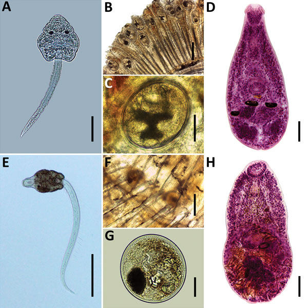 Species of heterophyids transmitted by Melanoides tuberculata snails in Peru. A–D) Centrocestus formosanus: cercaria (pleurolophocercous type) (A), encysted metacercariae in gills of Poecilia reticulata (B, C), and adult parasite obtained in experimentally infected mouse (D). E–H) Haplorchis pumilio: cercaria (parapleurolophocercous type) (E), metacercariae found at the base of the caudal fin of P. reticulata (F–G), and adult recovered in experimentally infected mouse (H). Scale bars indicate 50